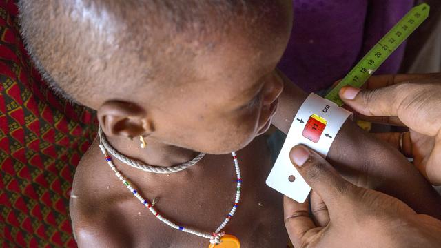 Egy fiatal lány tápláltsági állapotát mérik fel felkarkerület-mérőszalaggal a nigériai Borno állam Maiduguri városának egy színhelyén.  A szalagon található piros sáv azt jelzi, hogy fennáll nála a súlyos, akut alultápláltság veszélye.