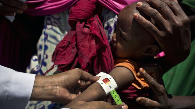 A Save the Children szervezet tagjai egy gyermek tápláltsági szintjét ellenőrzik Jemenben.